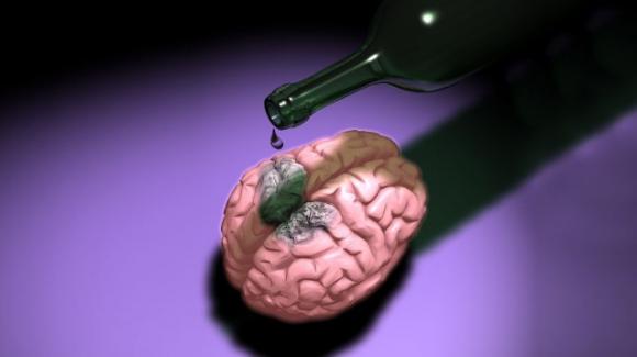 Modiche quantità di alcol danneggiano la materia grigia del cervello
