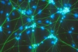 Università del Texas: identificati neuroni correlati all'abuso alcolico