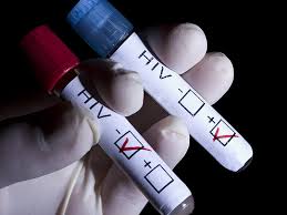 Sexually Transmitted Infections: test hiv, utile la diffusione sui social media