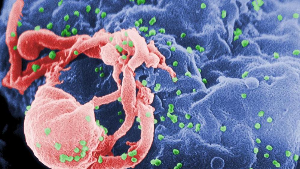 Aids: il falso mito del paziente zero