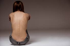 La Francia approva la legge anti-anoressia: modelle in passerella dopo visita medica