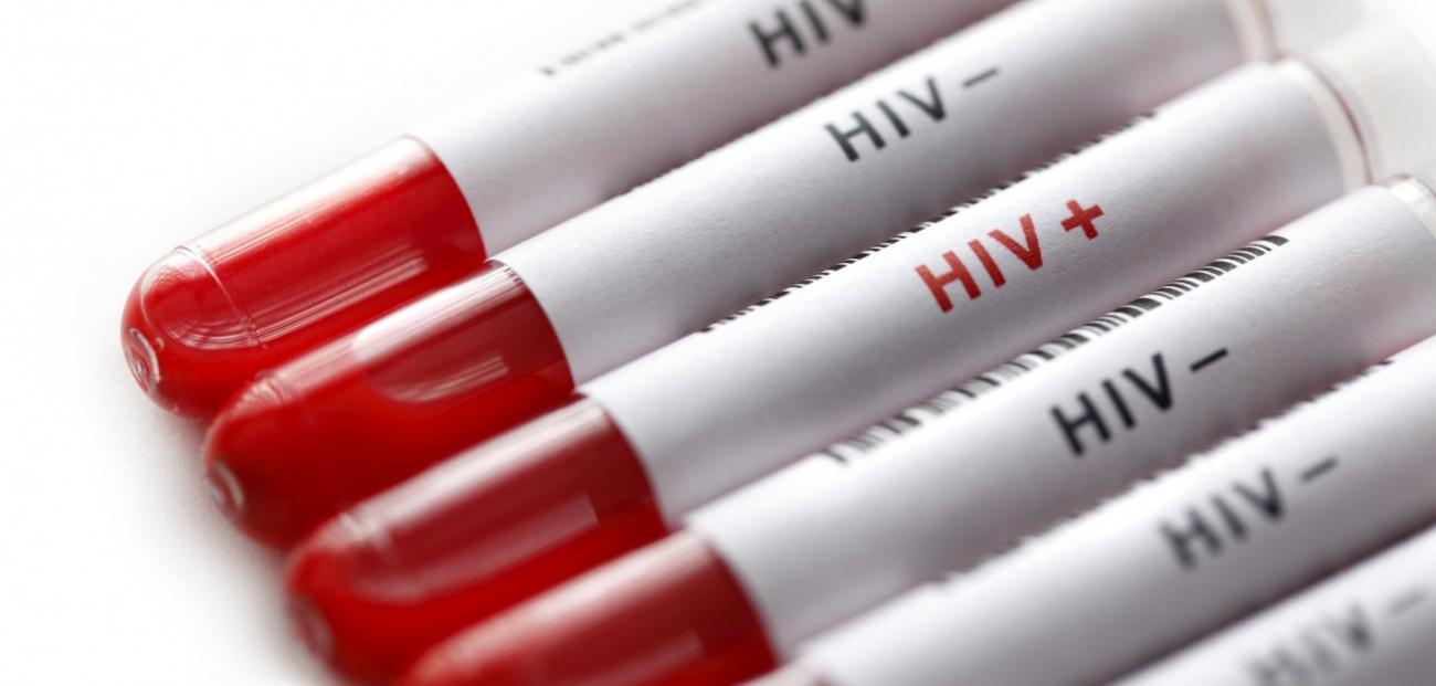 Aids: l'epidemia continua