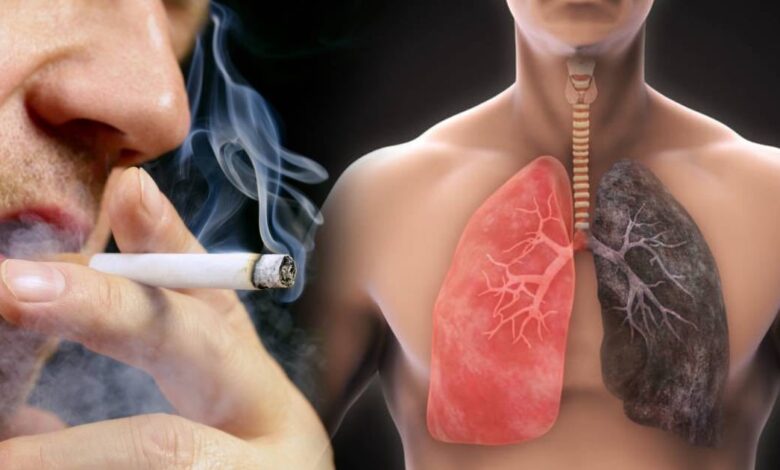 University College di Londra: i polmoni possono rigenerarsi se si smette di fumare